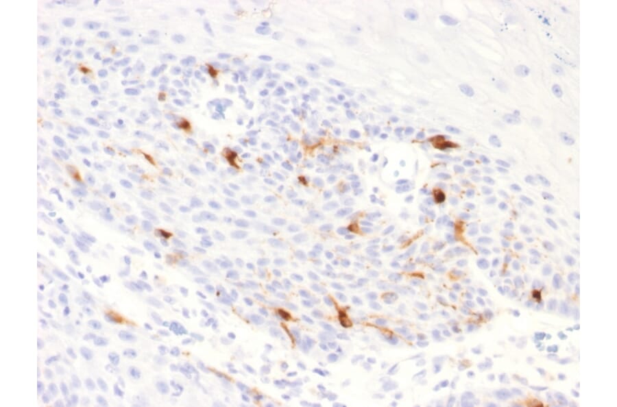 Immunohistochemistry - Anti-TRP1 Antibody [TYRP1/2340R] (A250258) - Antibodies.com