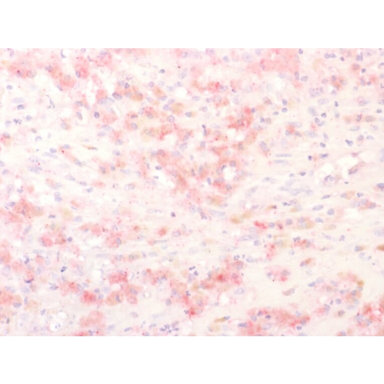 Immunohistochemistry - Anti-TRP1 Antibody (A250260) - Antibodies.com