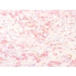 Immunohistochemistry - Anti-TRP1 Antibody (A250260) - Antibodies.com