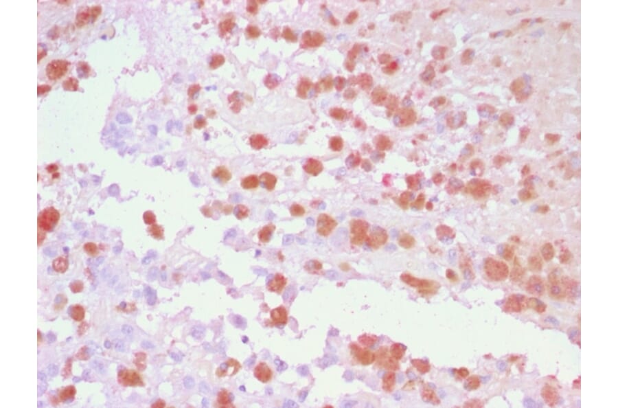 Immunohistochemistry - Anti-TRP1 Antibody (A250259) - Antibodies.com
