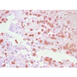 Immunohistochemistry - Anti-TRP1 Antibody (A250259) - Antibodies.com