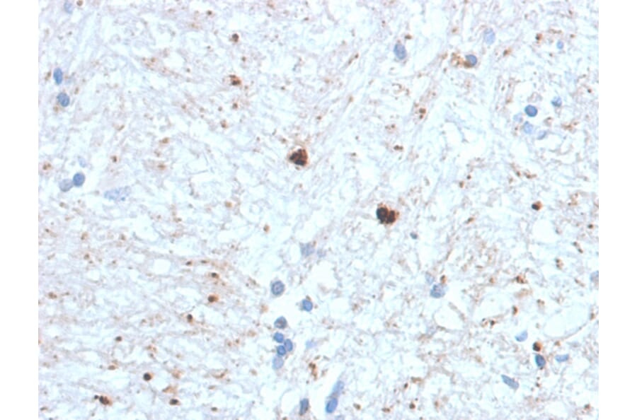 Immunohistochemistry - Anti-Ubiquitin Antibody [UBB/1748] (A250261) - Antibodies.com