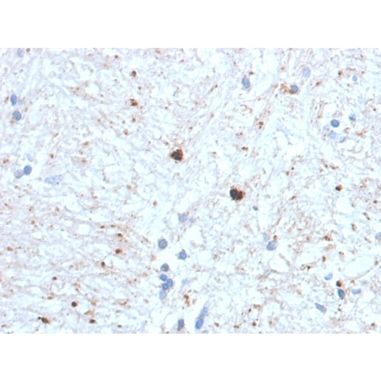 Immunohistochemistry - Anti-Ubiquitin Antibody [UBB/1748] (A250261) - Antibodies.com