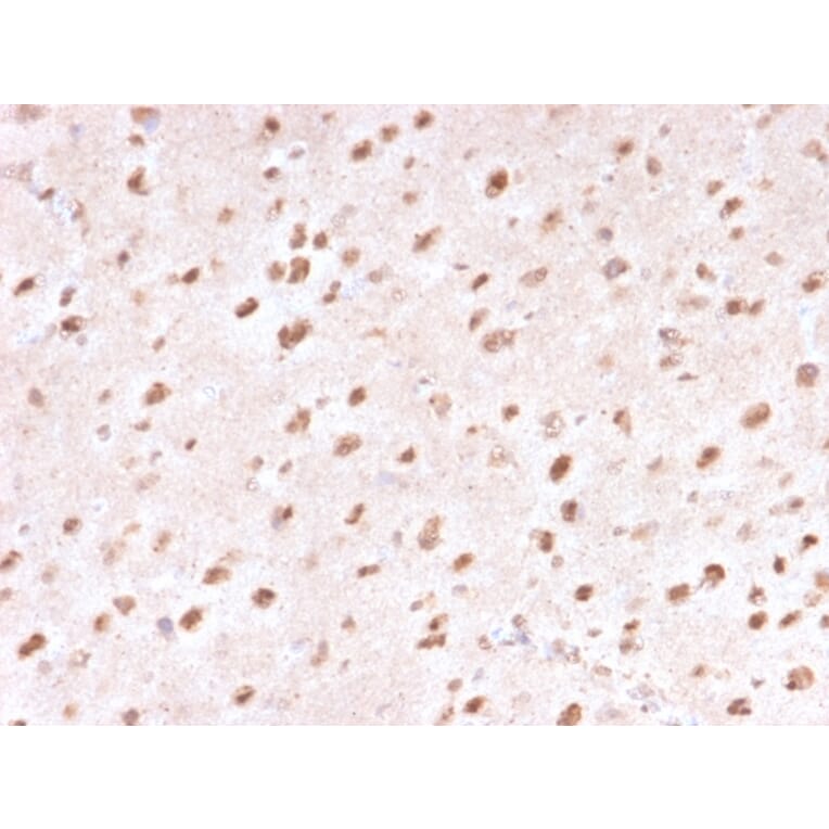 Immunohistochemistry - Anti-Ubiquitin Antibody [UBB/1748] (A250261) - Antibodies.com