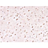 Immunohistochemistry - Anti-Ubiquitin Antibody [UBB/1748] (A250261) - Antibodies.com