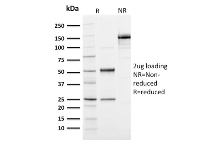 SDS-PAGE - Anti-Ubiquitin Antibody [UBB/1748] (A250261) - Antibodies.com