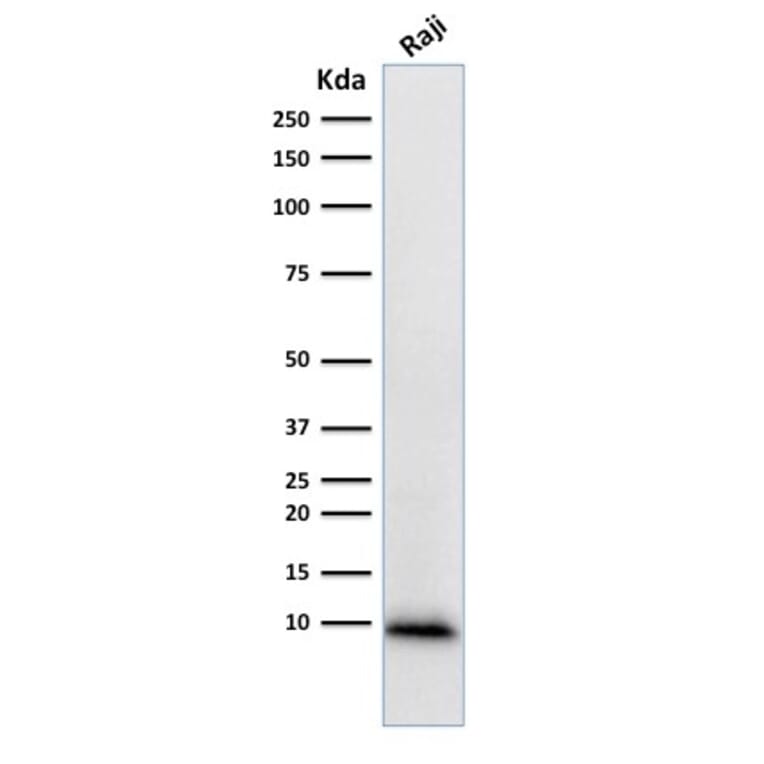 Western Blot - Anti-Ubiquitin Antibody [UBB/1748] (A250261) - Antibodies.com