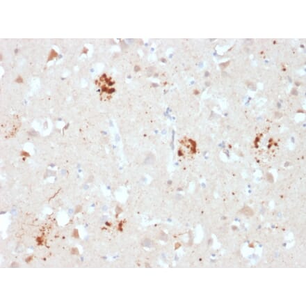 Immunohistochemistry - Anti-Ubiquitin Antibody [UBB/2122] (A250262) - Antibodies.com