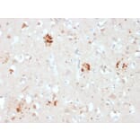 Immunohistochemistry - Anti-Ubiquitin Antibody [UBB/2122] (A250262) - Antibodies.com