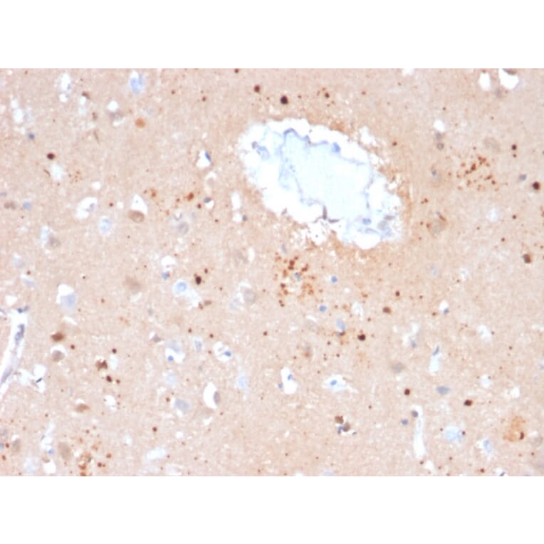 Immunohistochemistry - Anti-Ubiquitin Antibody [UBB/2122] (A250262) - Antibodies.com