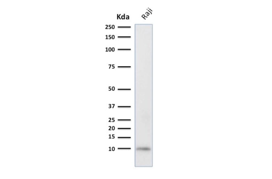 Western Blot - Anti-Ubiquitin Antibody [UBB/2122] (A250262) - Antibodies.com
