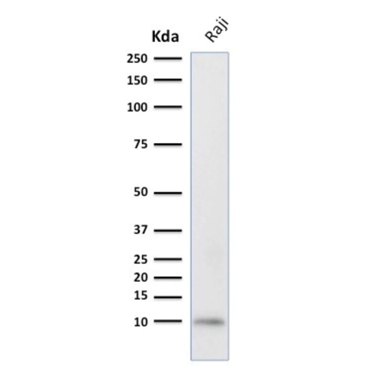 Western Blot - Anti-Ubiquitin Antibody [UBB/2122] (A250262) - Antibodies.com