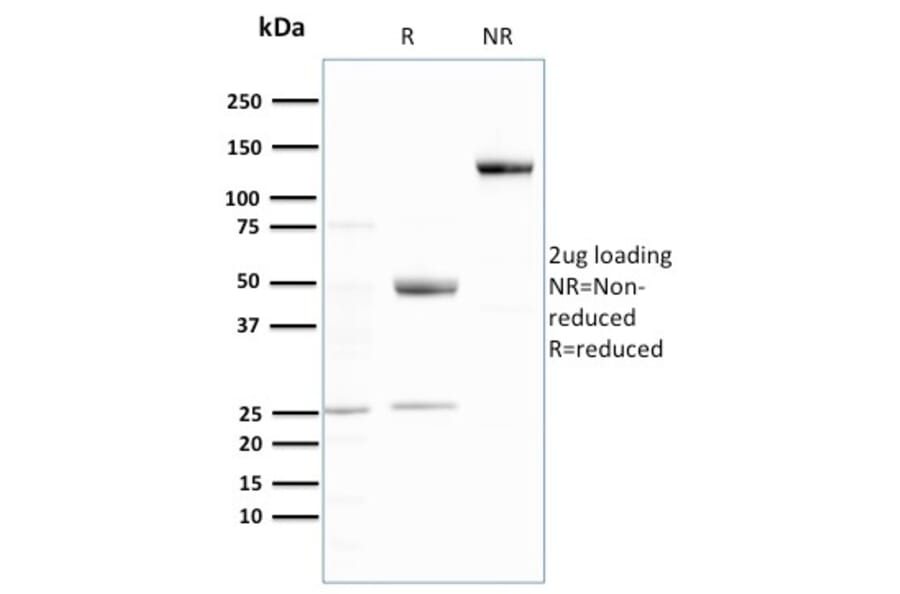 SDS-PAGE - Anti-Ubiquitin Antibody [UBB/3143R] (A250263) - Antibodies.com