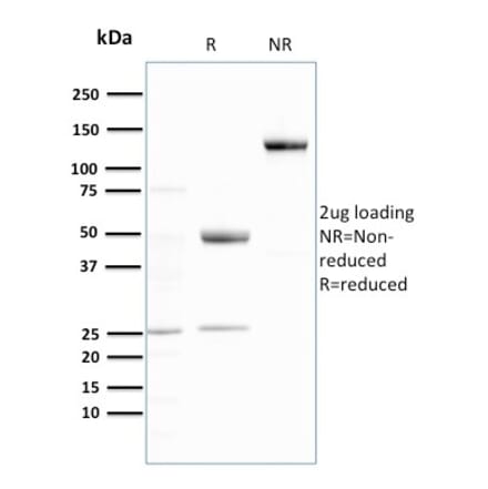 SDS-PAGE - Anti-Ubiquitin Antibody [UBB/3143R] (A250263) - Antibodies.com