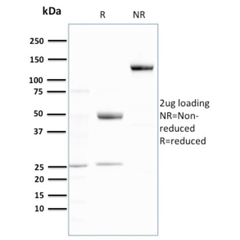 SDS-PAGE - Anti-Ubiquitin Antibody [UBB/3143R] (A250263) - Antibodies.com