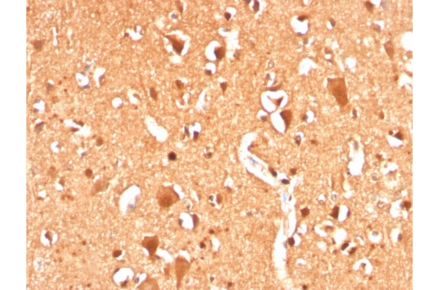 Immunohistochemistry - Anti-Ubiquitin Antibody [UBB/3143R] (A250262) - Antibodies.com