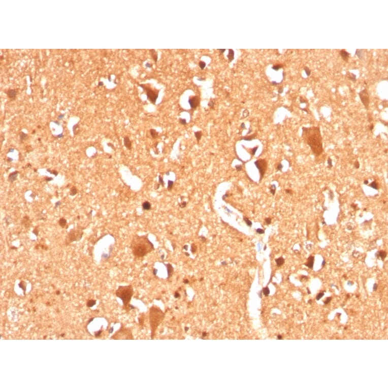 Immunohistochemistry - Anti-Ubiquitin Antibody [UBB/3143R] (A250262) - Antibodies.com