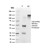 SDS-PAGE - Anti-UBE3A Antibody [PCRP-UBE3A-1A2] (A250265) - Antibodies.com