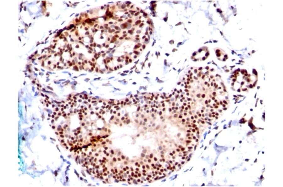 Immunohistochemistry - Anti-SUMO-1 Antibody [SM1/495] (A250266) - Antibodies.com