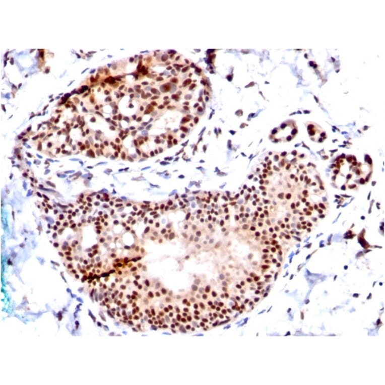 Immunohistochemistry - Anti-SUMO-1 Antibody [SM1/495] (A250266) - Antibodies.com