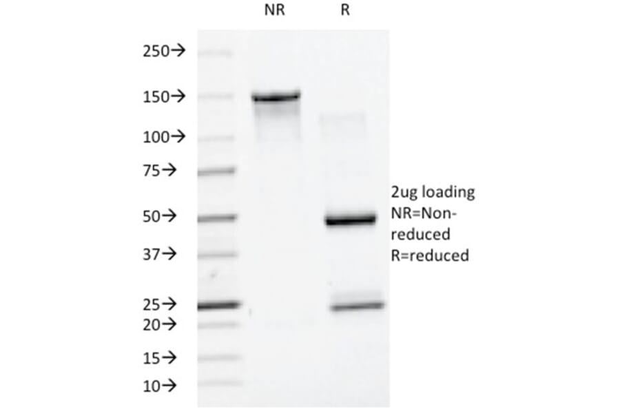 SDS-PAGE - Anti-SUMO-1 Antibody [SM1/495] (A250266) - Antibodies.com