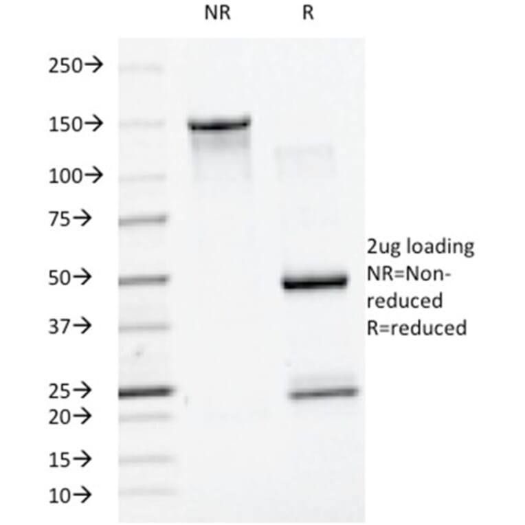SDS-PAGE - Anti-SUMO-1 Antibody [SM1/495] (A250266) - Antibodies.com