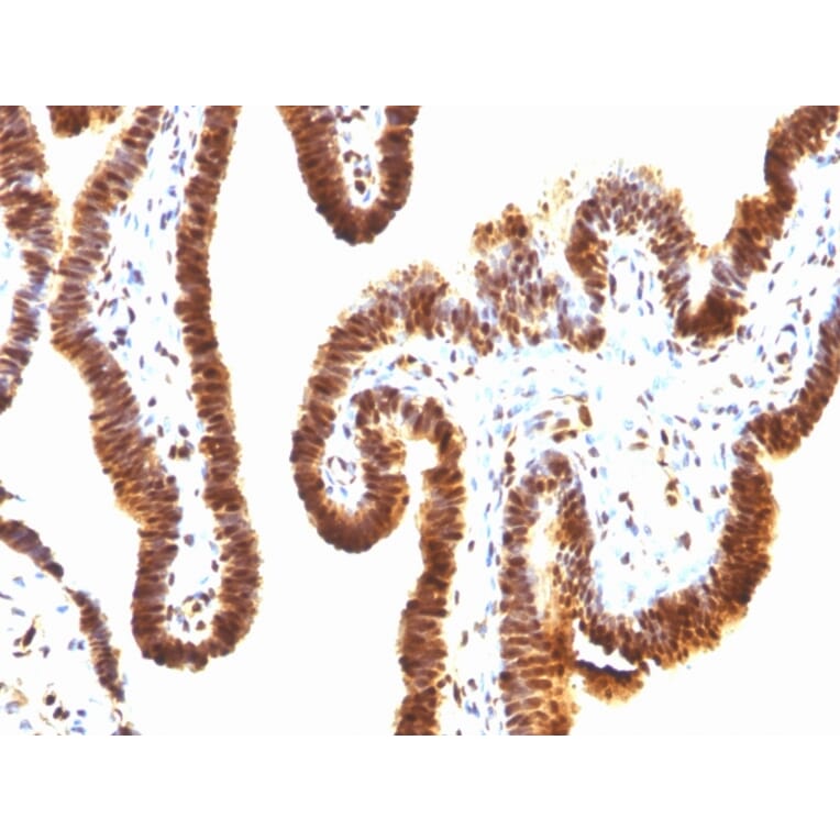 Immunohistochemistry - Anti-SUMO-1 Antibody [SPM571] (A250266) - Antibodies.com