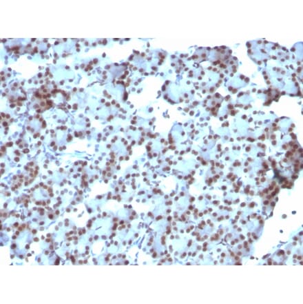 Immunohistochemistry - Anti-SUMO-1 Antibody [SUMO1/1188] (A250267) - Antibodies.com