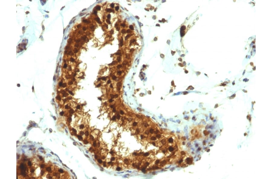 Immunohistochemistry - Anti-SUMO-1 Antibody [SUMO1/1188] (A250268) - Antibodies.com