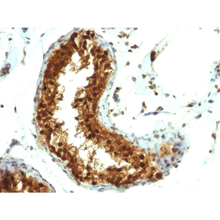 Immunohistochemistry - Anti-SUMO-1 Antibody [SUMO1/1188] (A250268) - Antibodies.com