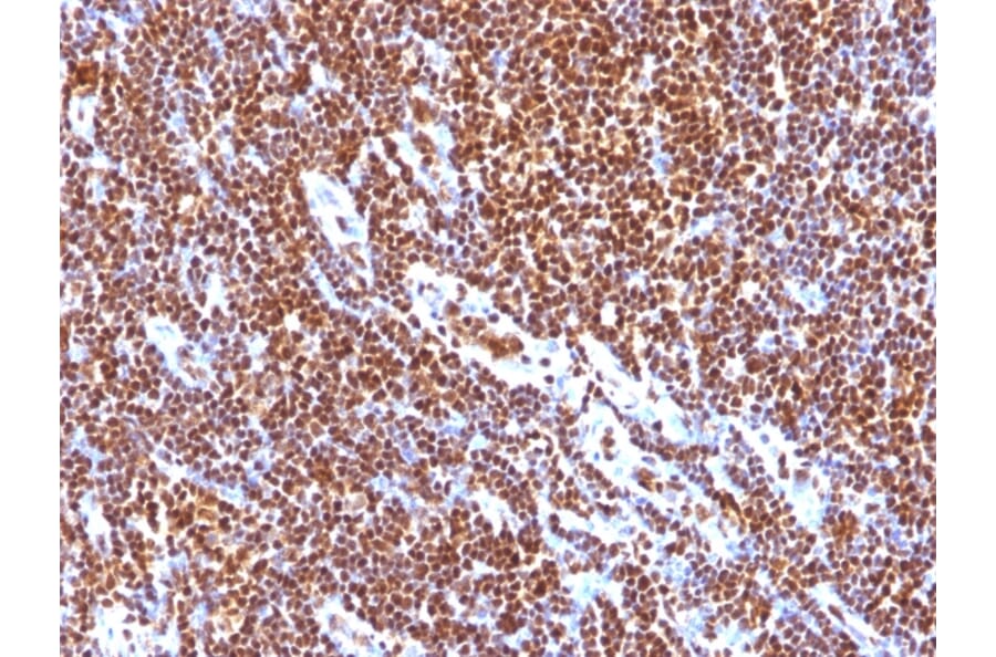 Immunohistochemistry - Anti-SUMO-1 Antibody [SUMO1/1188] (A250268) - Antibodies.com