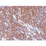Immunohistochemistry - Anti-SUMO-1 Antibody [SUMO1/1188] (A250268) - Antibodies.com