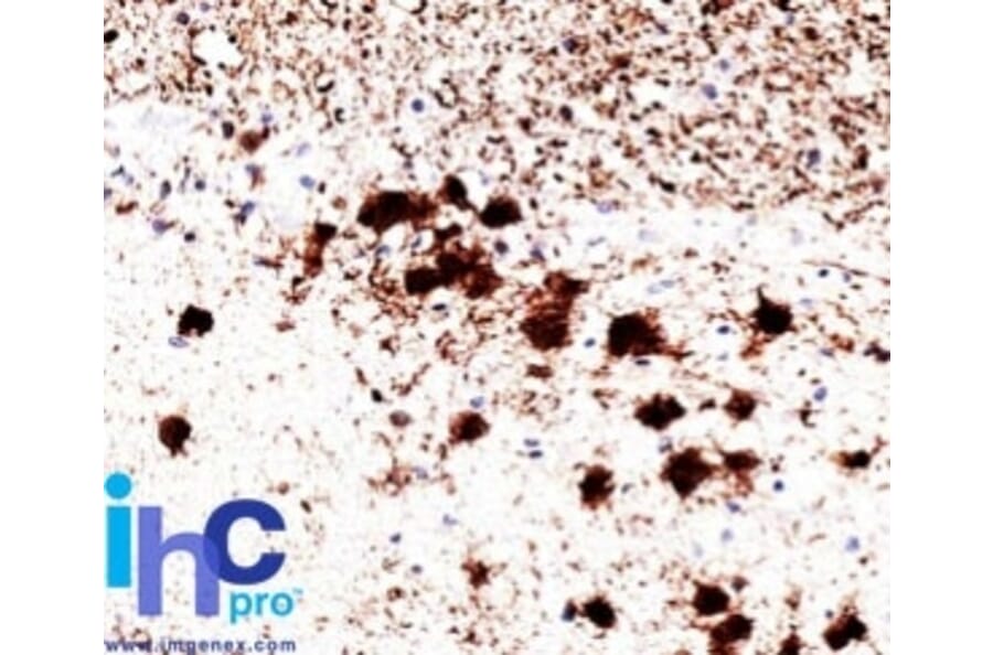 Immunohistochemistry - Anti-PGP9.5 Antibody [31A3] (A250269) - Antibodies.com