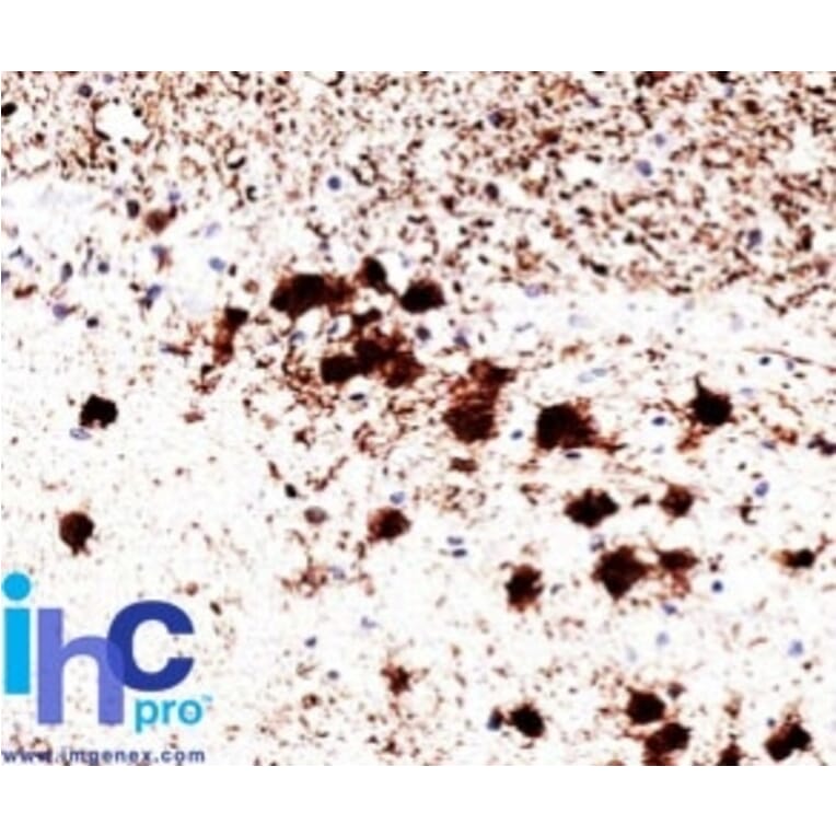 Immunohistochemistry - Anti-PGP9.5 Antibody [31A3] (A250269) - Antibodies.com