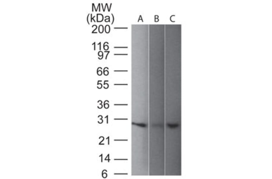 Western Blot - Anti-PGP9.5 Antibody [31A3] (A250269) - Antibodies.com