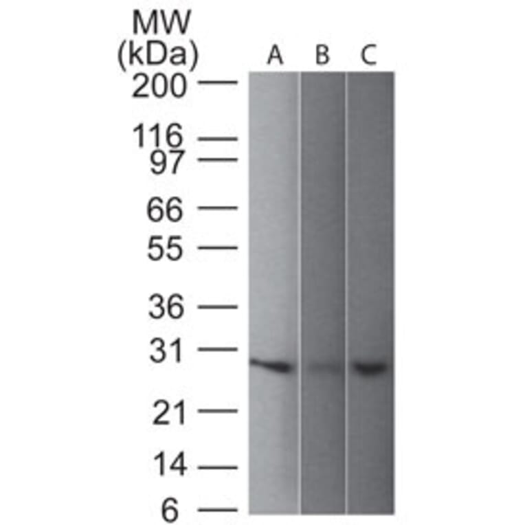 Western Blot - Anti-PGP9.5 Antibody [31A3] (A250269) - Antibodies.com