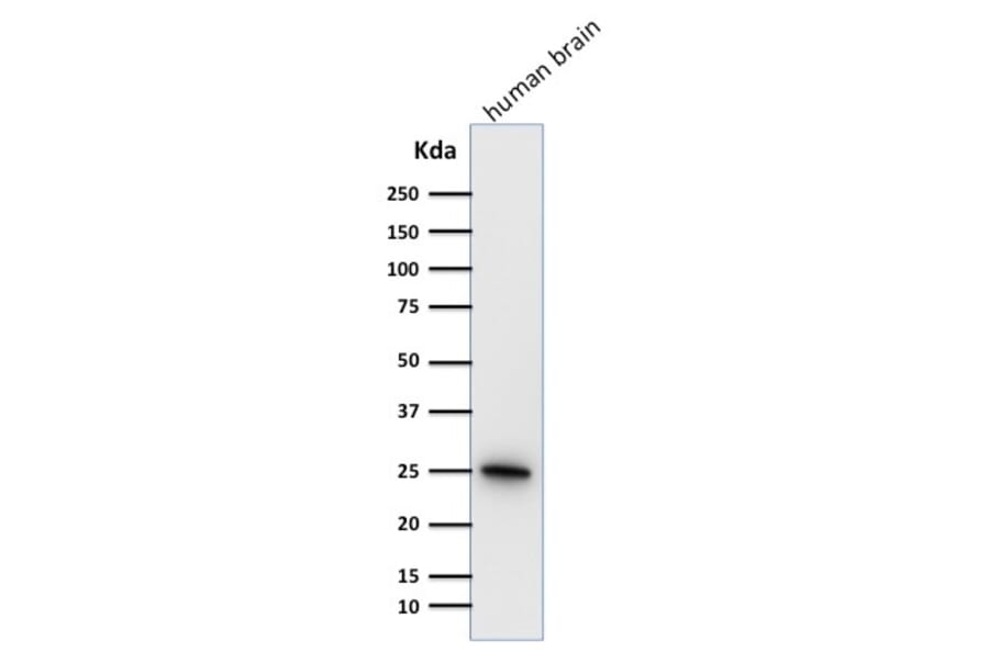 Western Blot - Anti-PGP9.5 Antibody [31A3] (A250269) - Antibodies.com