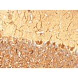 Immunohistochemistry - Anti-PGP9.5 Antibody [SPM574] (A250270) - Antibodies.com