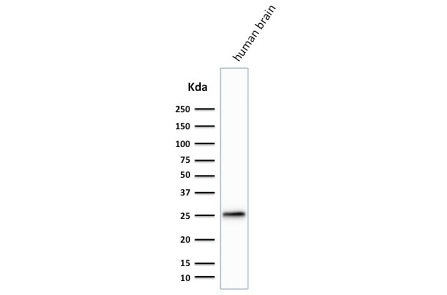 Western Blot - Anti-PGP9.5 Antibody [SPM574] (A250270) - Antibodies.com