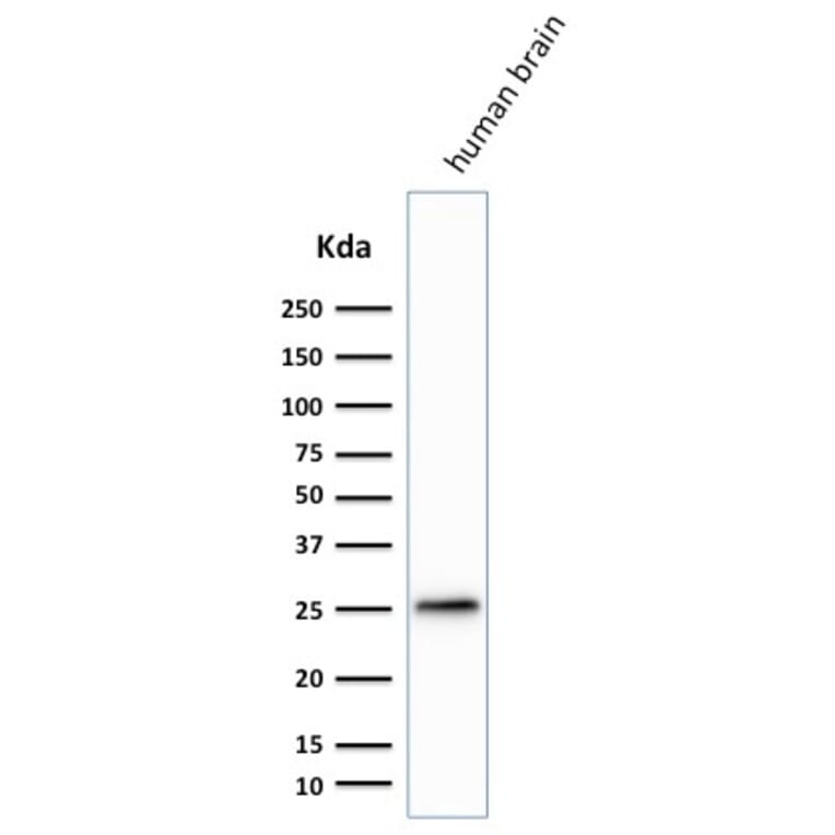 Western Blot - Anti-PGP9.5 Antibody [SPM574] (A250270) - Antibodies.com