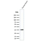Western Blot - Anti-PGP9.5 Antibody [SPM574] (A250270) - Antibodies.com