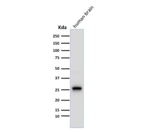 Western Blot - Anti-PGP9.5 Antibody [13C4] (A250271) - Antibodies.com