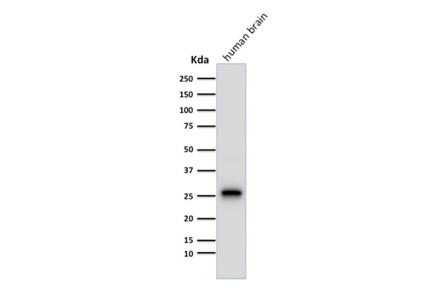 Western Blot - Anti-PGP9.5 Antibody [13C4] (A250271) - Antibodies.com