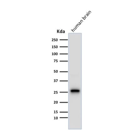 Western Blot - Anti-PGP9.5 Antibody [13C4] (A250271) - Antibodies.com