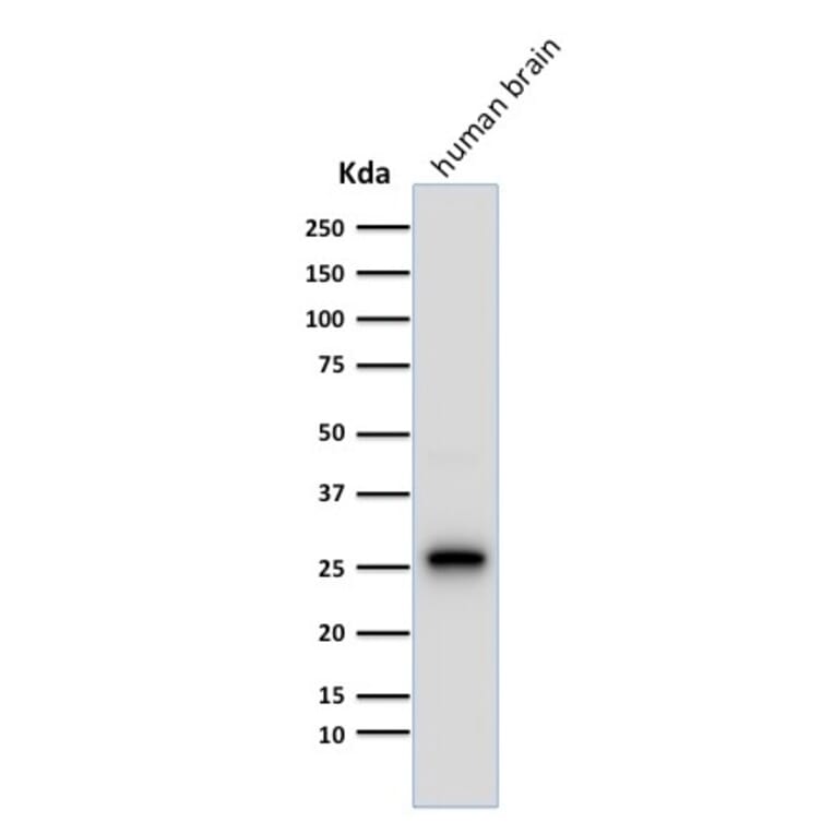 Western Blot - Anti-PGP9.5 Antibody [13C4] (A250271) - Antibodies.com