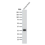 Western Blot - Anti-PGP9.5 Antibody [13C4] (A250271) - Antibodies.com