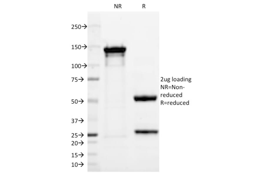 SDS-PAGE - Anti-PGP9.5 Antibody [13C4] (A250271) - Antibodies.com