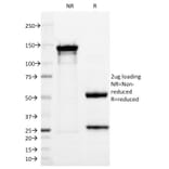 SDS-PAGE - Anti-PGP9.5 Antibody [13C4] (A250271) - Antibodies.com