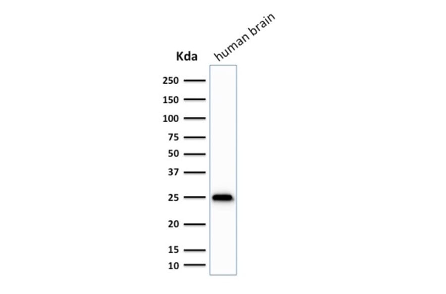 Western Blot - Anti-PGP9.5 Antibody [SPM575] (A250272) - Antibodies.com