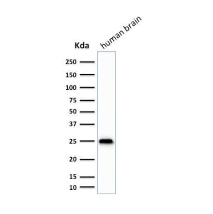 Western Blot - Anti-PGP9.5 Antibody [SPM575] (A250272) - Antibodies.com